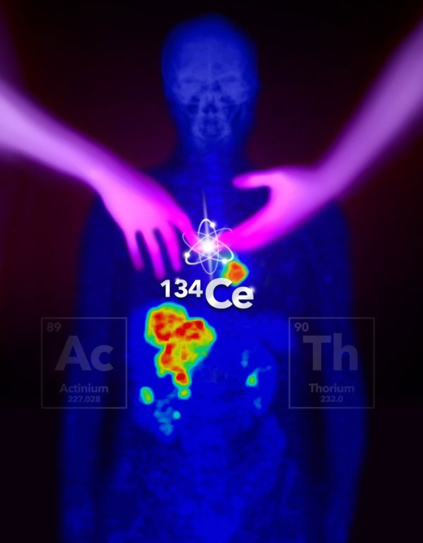 Cerium-134 can be targeted to provide an imaging analogue for two different therapy isotopes, actinium-225 and thorium-227. This helps scientists understand these therapy isotopes and develop new treatments. These novel isotopes are being developed and produced by the DOE Isotope Program.