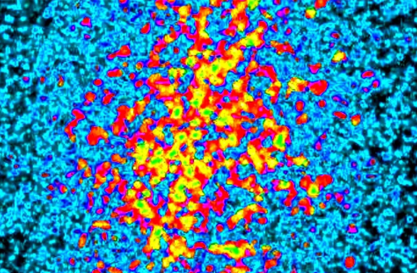 A speckle pattern showing yellow and green blobs in the middle, surrounded by red, and a background of speckled bright blue against black