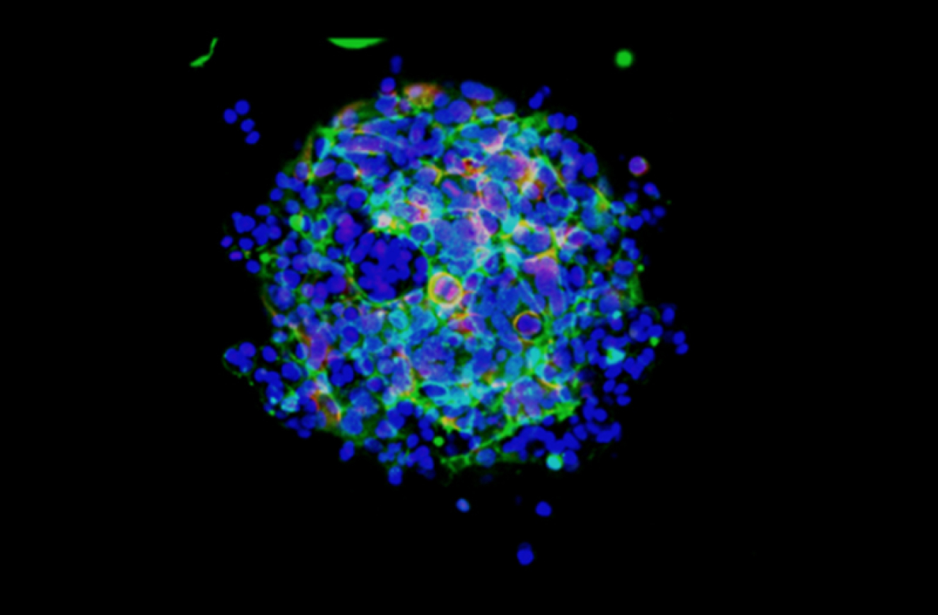 A fluorescent blob pops against a black background. Light blues and pinks are dotted with tiny, dark blue clumps while lime green lines stretch across the sphere’s surface, revealing a highway of interconnected cellular activity.