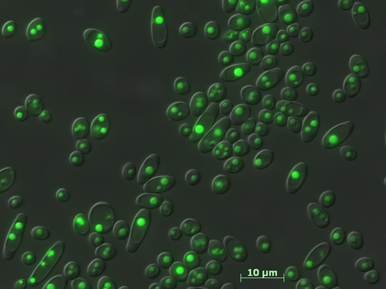 An image of yeast cells. 