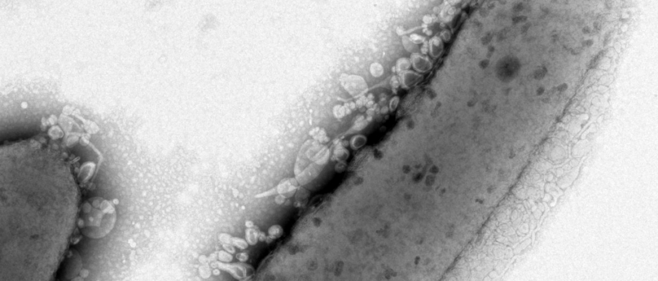 This image of a bacterial cell shows lipid droplets on the exterior of the cell wall. The lipids have escaped through a cell envelope that has been modified to increase lipid production.