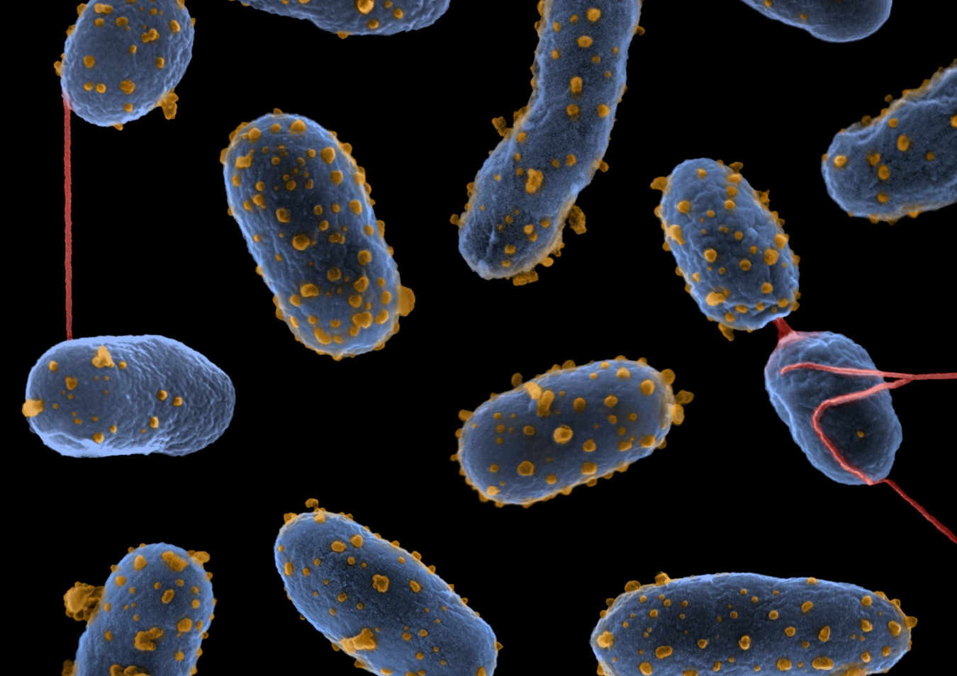 Picture of bacterium Pseudomonas putida 