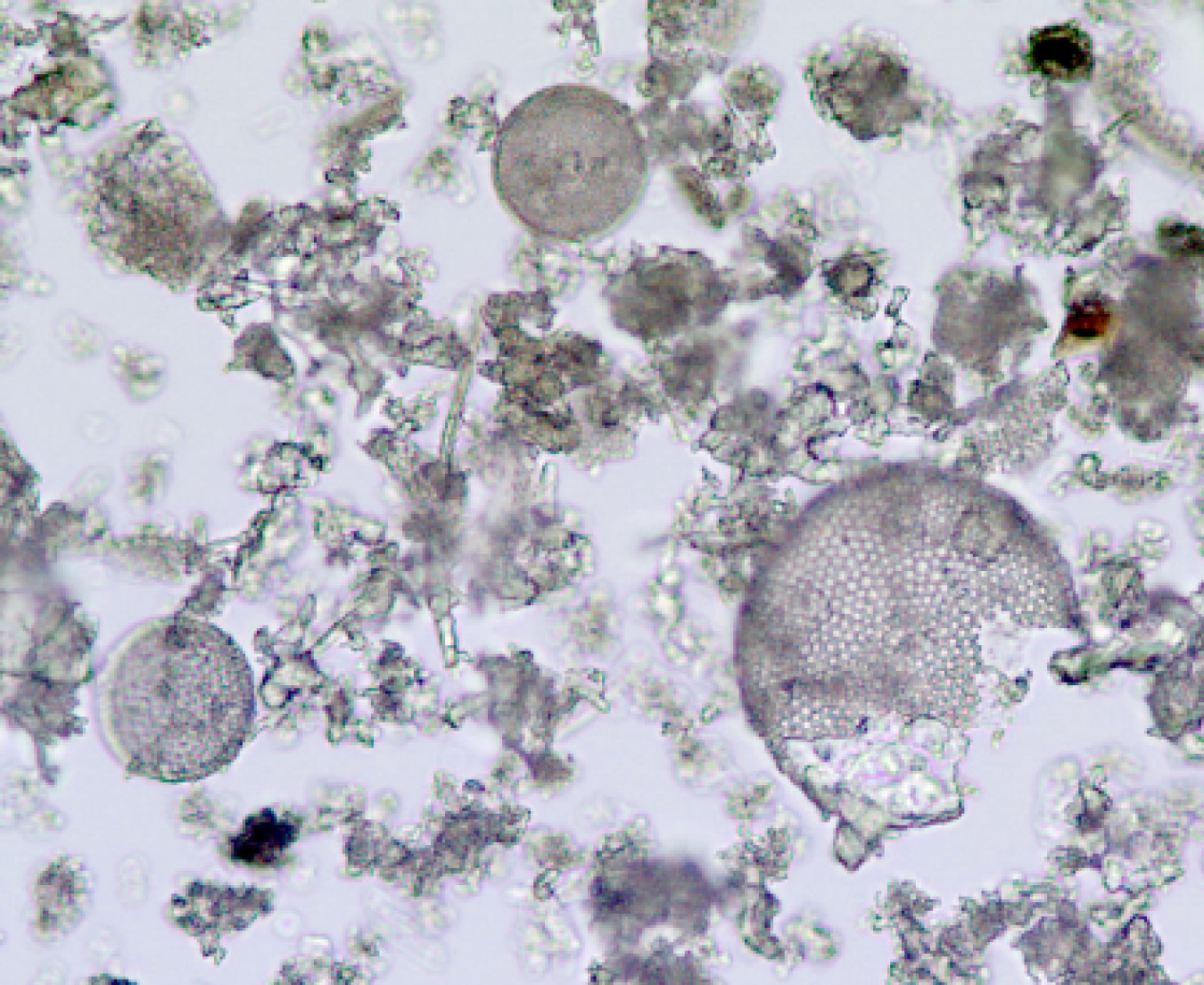 Diatom shells in commercial diatomaceous 2.png